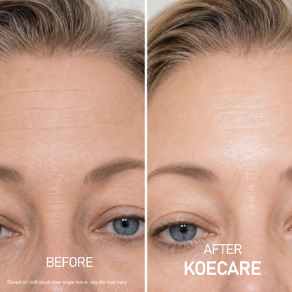 Koecare® Silk Peptide Serum