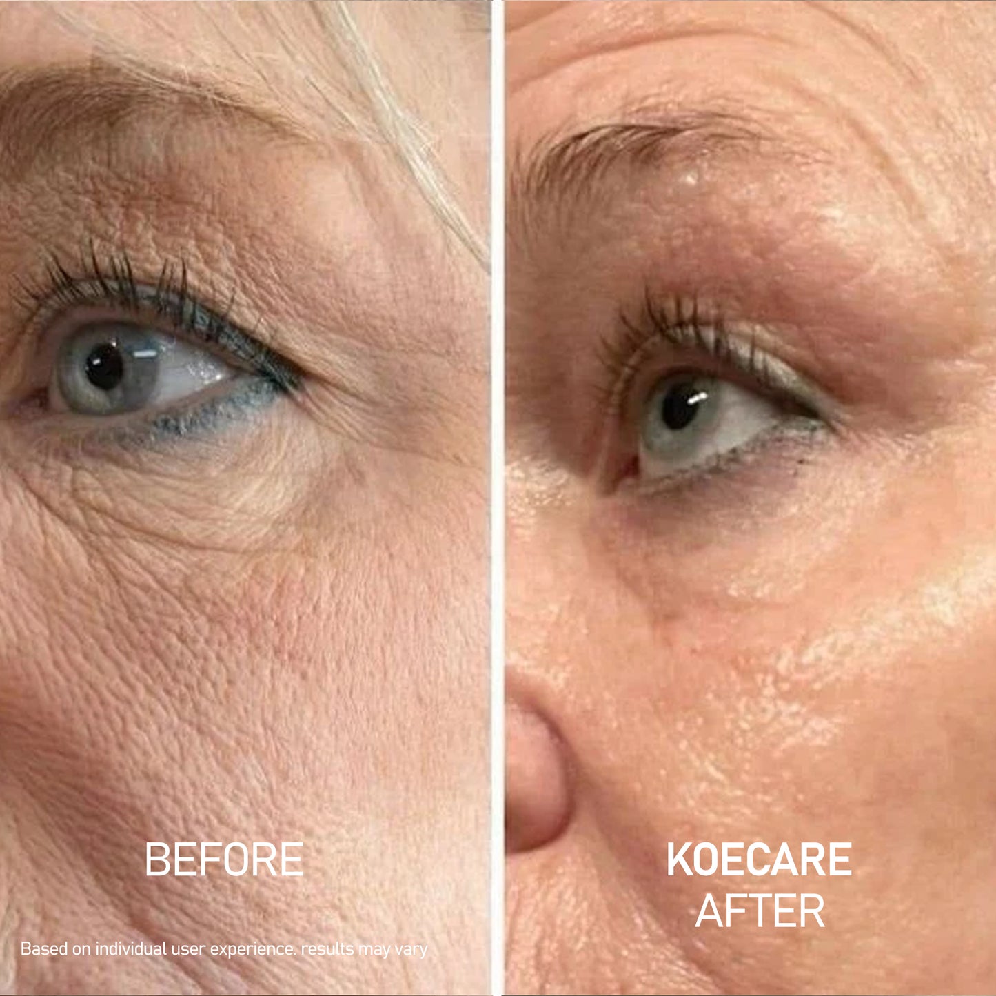 Koecare® Silk Peptide Serum