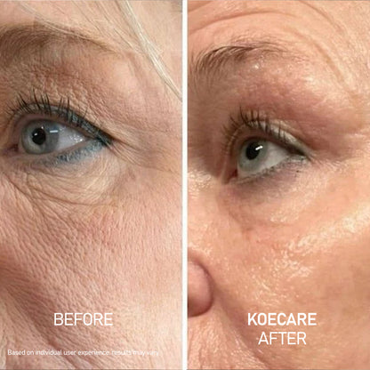 Koecare® Silk Peptide Serum