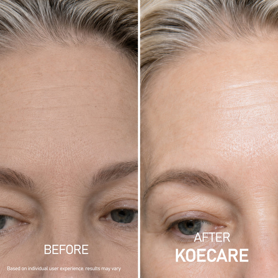 Skincare result image