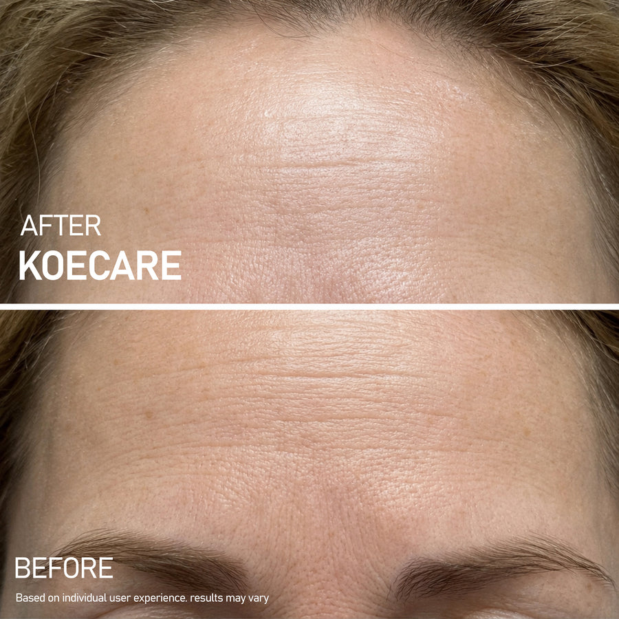 Skincare result image