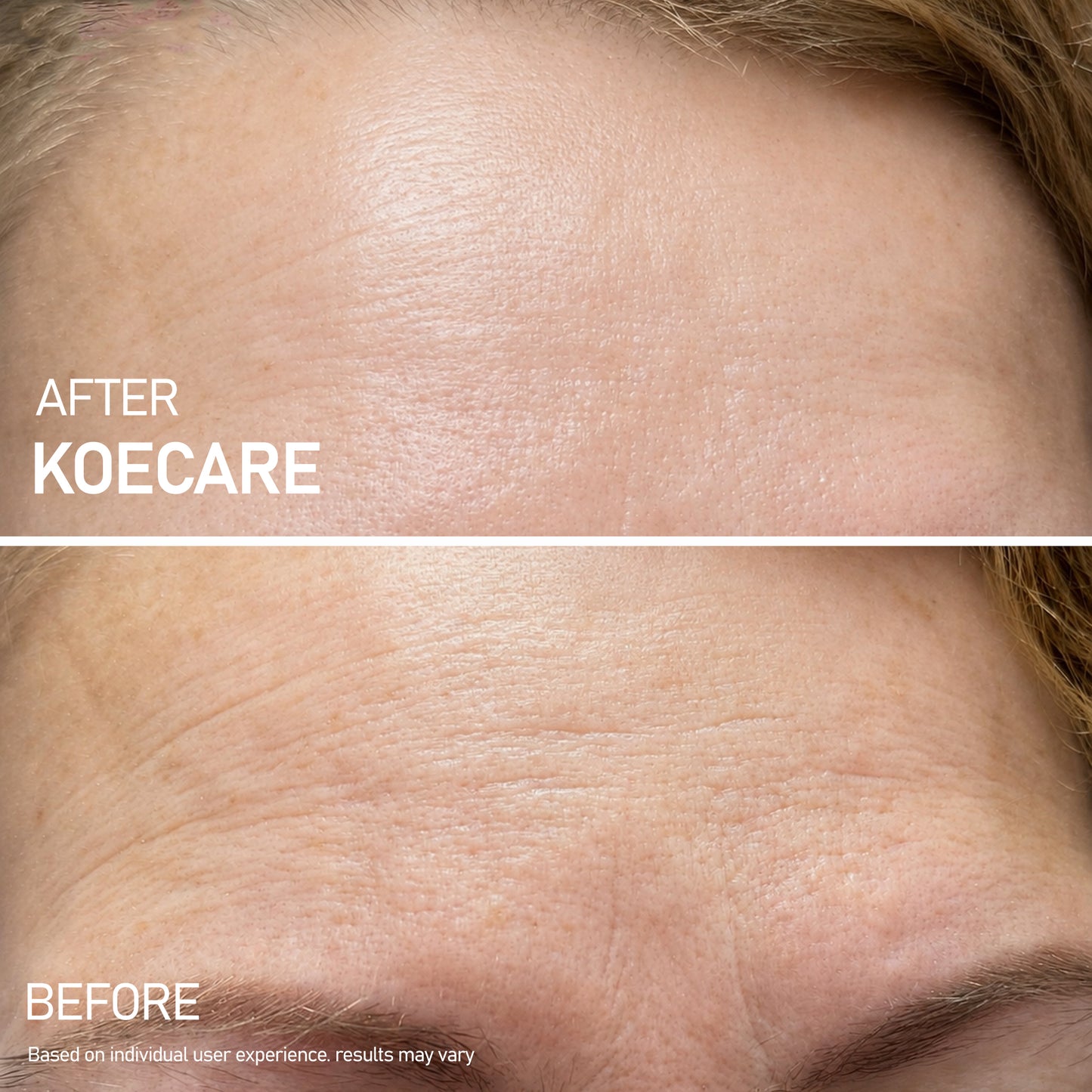 Koecare® Silk Peptide Serum
