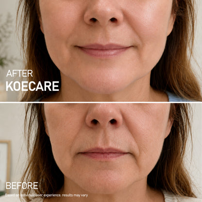 Koecare® Silk Peptide Serum