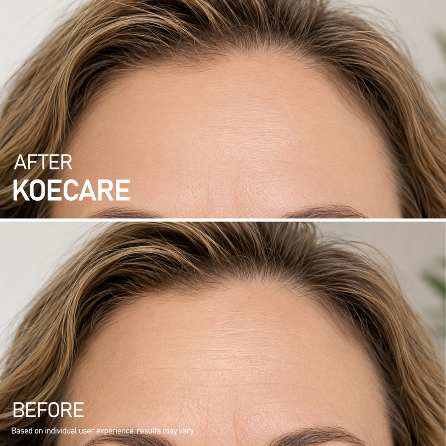KOECARE skincare result